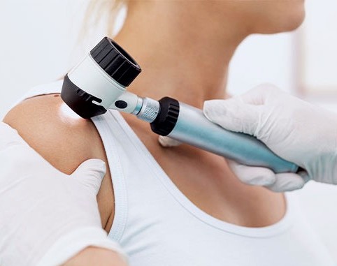 dermatologische-untersuchung-muttermal